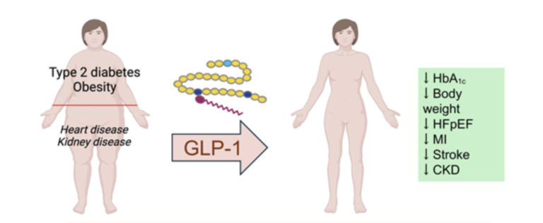 การทำความเข้าใจผลกระทบของ GLP-1 ต่อการจัดการโรคเบาหวาน