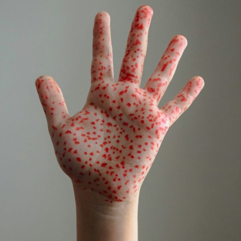 วิธีธรรมชาติของการดูแลสุขภาพที่ยอดเยี่ยม