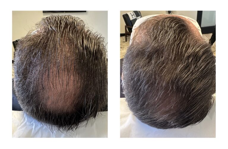 ศาสตร์แห่งสุขภาพของหนังศีรษะ